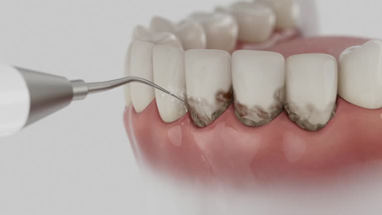 Reliable Dental contractor in Three Way, TN by Smile Center Dentistry